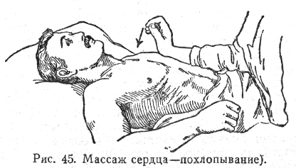 Массаж сердца - похлоаывание